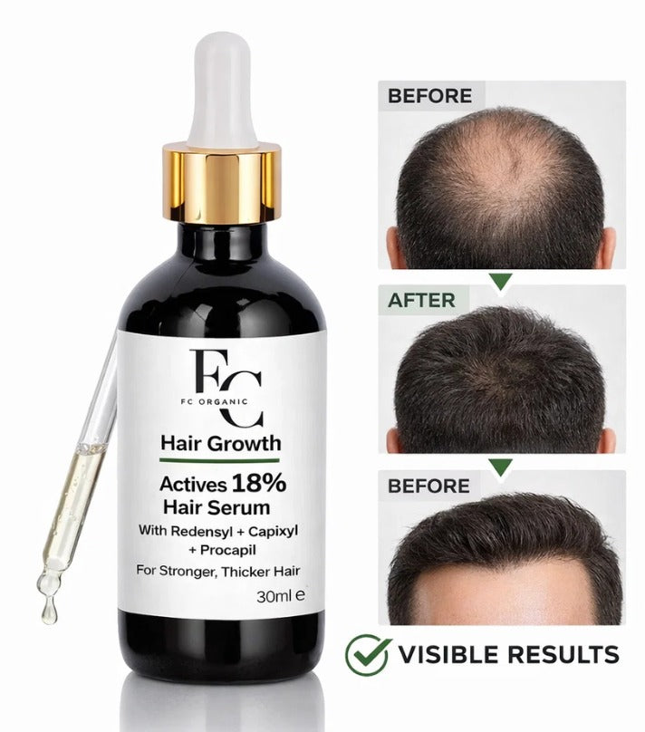 Herbal Hair Growth Serum 30ml | Rosemary &amp; Onion Wate