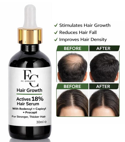 Herbal Hair Growth Serum 30ml | Rosemary &amp; Onion Wate